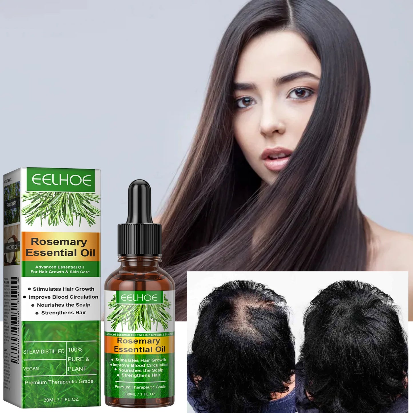 30ML Rosemary Hair Care Elixir: Anti-Breakage, Dense Growth & Nourishing Scalp Oil