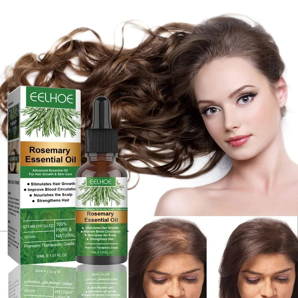 30ML Rosemary Hair Care Elixir: Anti-Breakage, Dense Growth & Nourishing Scalp Oil