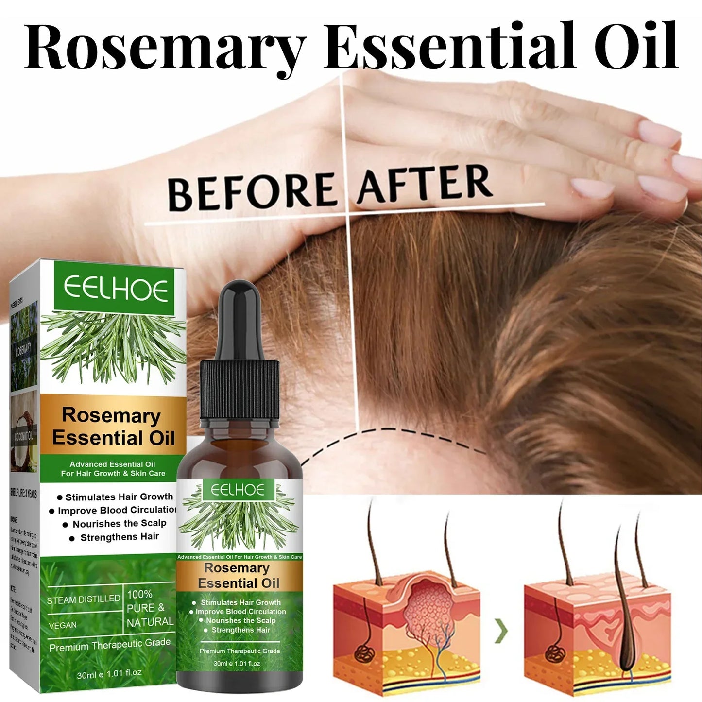 30ML Rosemary Hair Care Elixir: Anti-Breakage, Dense Growth & Nourishing Scalp Oil